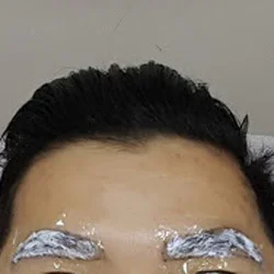 Vệ sinh, ủ tê vùng da trước khi phun mày Nano chạm hạt