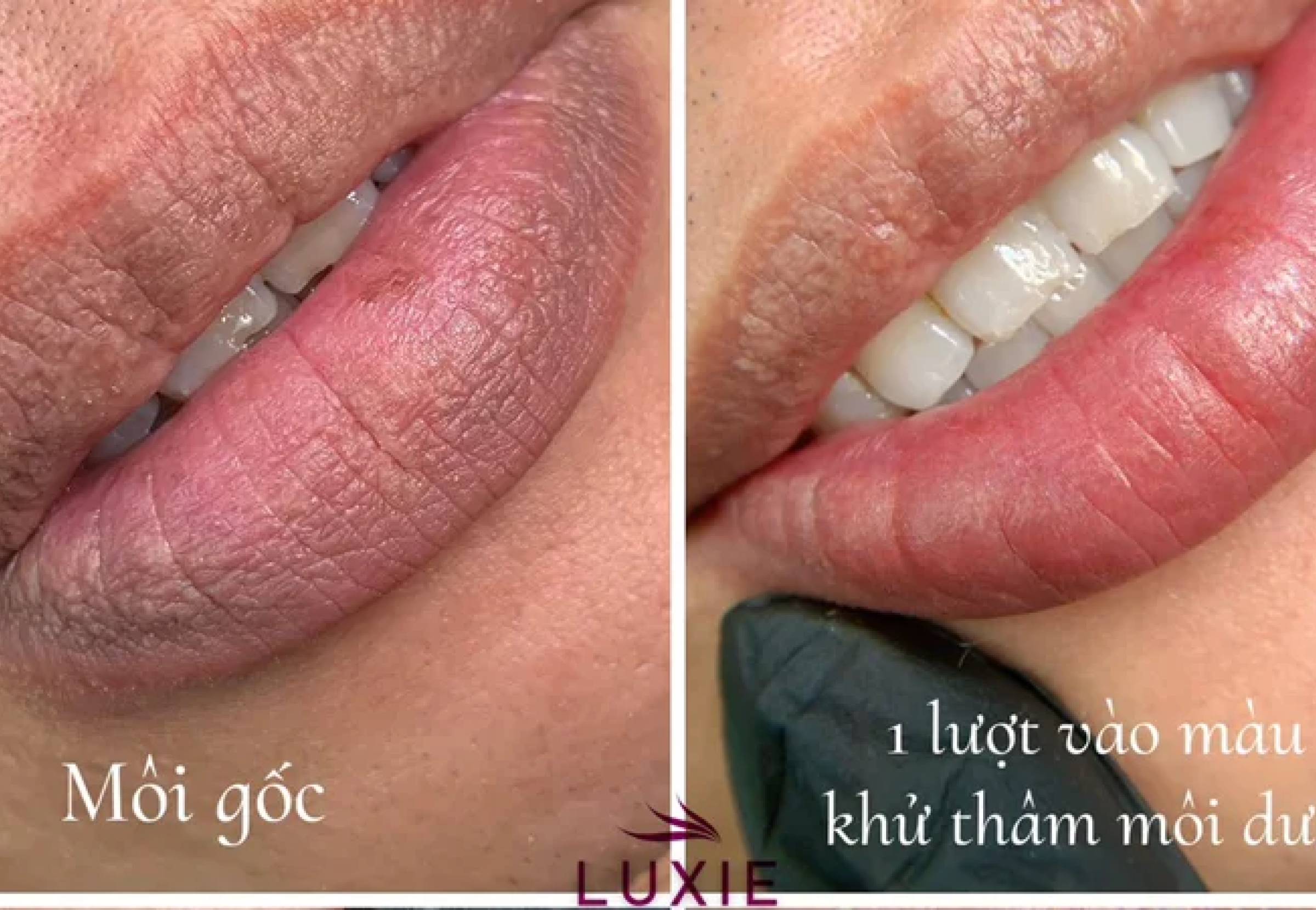Phun xăm khử thâm môi: Đánh thức vẻ đẹp tiềm ẩn, nâng tầm sự tự tin