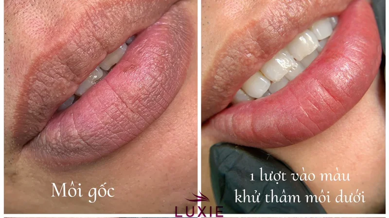 Phun xăm khử thâm môi: Đánh thức vẻ đẹp tiềm ẩn, nâng tầm sự tự tin