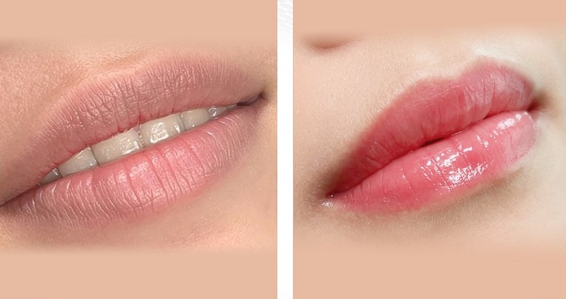 CÔNG NGHỆ KHỬ THÂM MÔI NAM/NỮ LÀ GÌ?