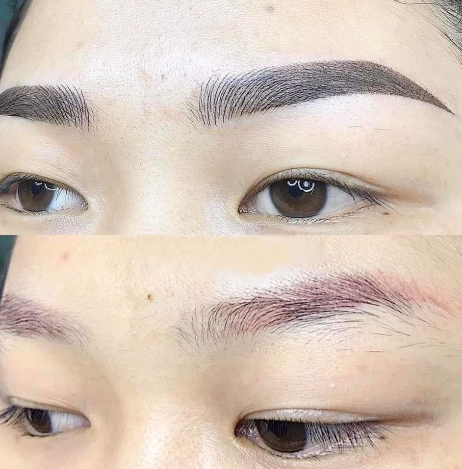 Những phương pháp xử lý lông mày trổ xanh đỏ