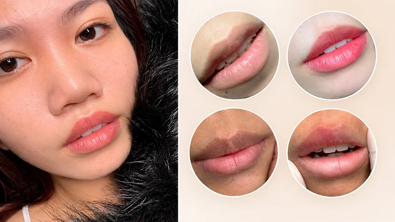 Hình ảnh thực tế khách hàng sử dụng dịch vụ khử thâm tại Luxie Hình ảnh thực tế khách hàng sử dụng dịch vụ khử thâm tại Luxie