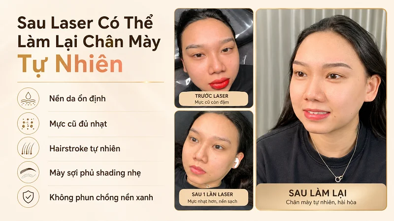 Sau laser có thể làm lại chân mày tự nhiên không? Sau laser có thể làm lại chân mày tự nhiên không?