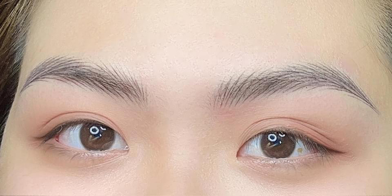 Hãy cân nhắc kỹ các ưu và nhược điểm của phương pháp làm đẹp này trước khi quyết định sử dụng