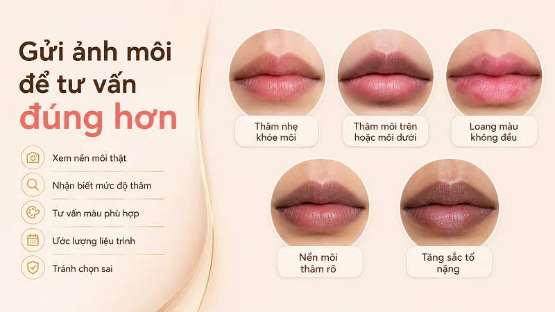 Tại sao cần gửi ảnh môi trước khi được tư vấn? Tại sao cần gửi ảnh môi trước khi được tư vấn?