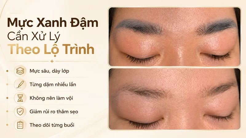 Khi nào mày trổ xanh cần xử lý nhiều buổi? Khi nào mày trổ xanh cần xử lý nhiều buổi?