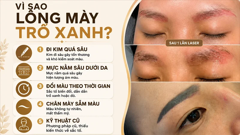 Những lý do khiến lông mày của bạn trổ xanh đỏ