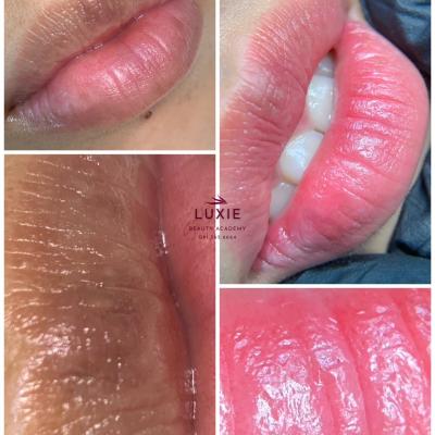 Khách hàng sử dụng dịch vụ khử thâm môi tại Luxie